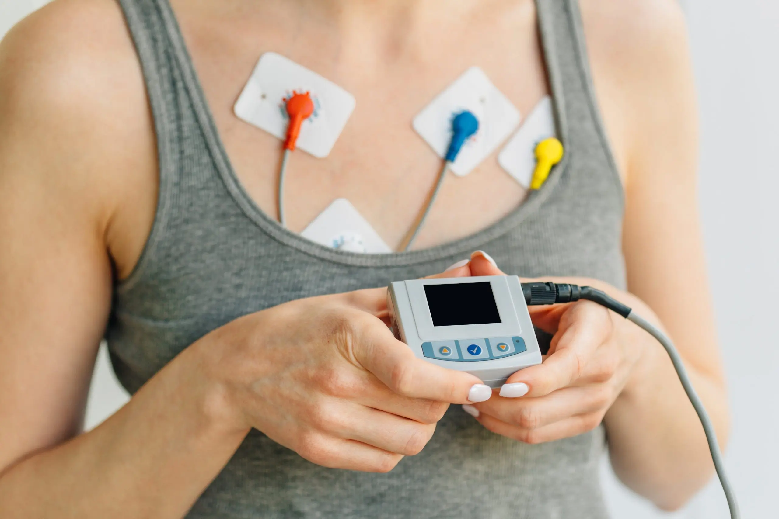 Holter EKG Cluj-Napoca – Monitorizare 24h, 48h și 72h la abest cardio