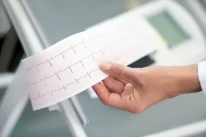 De ce persistă durerile toracice chiar dacă ECG-ul este normal?