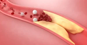 Cum interpretez analizele de colesterol LDL și HDL? Ghid practic